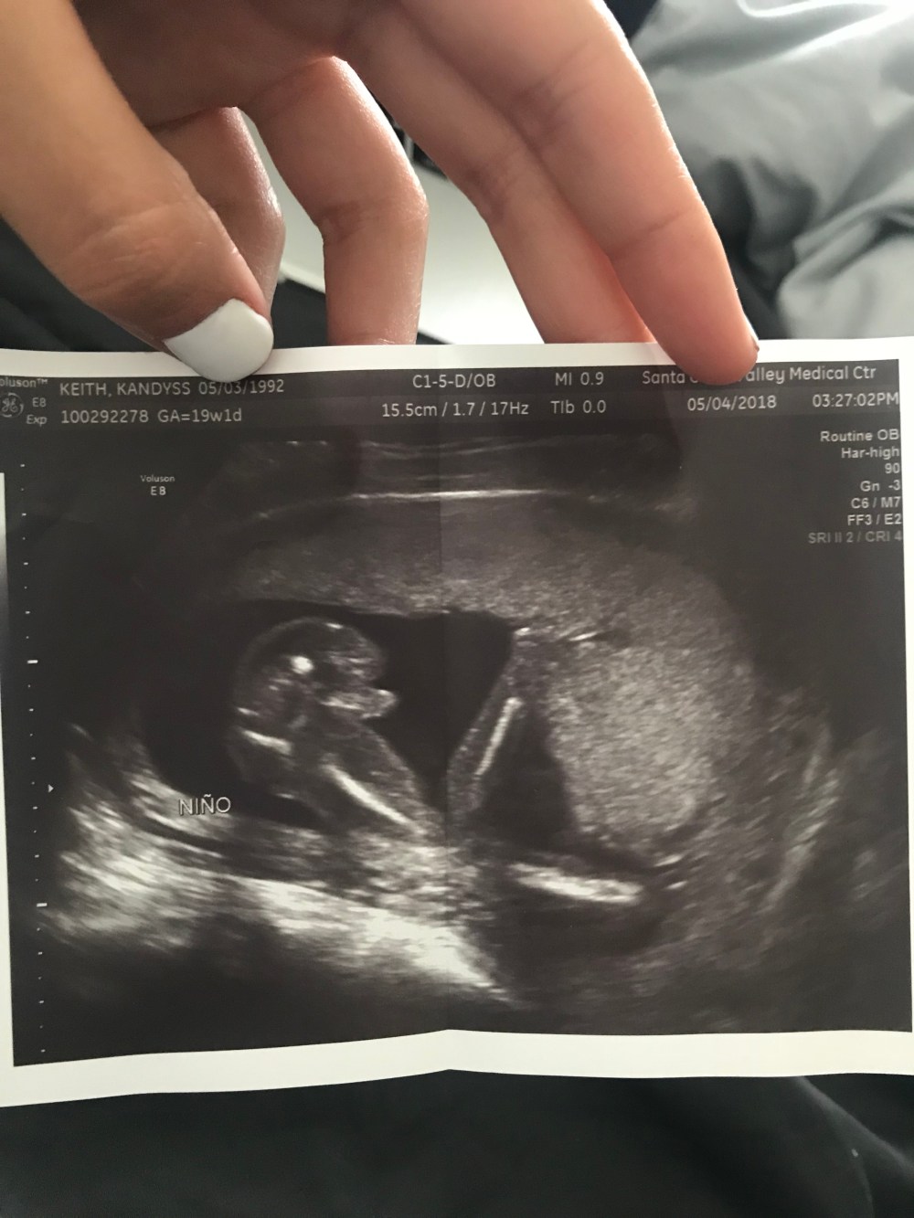 AD09F7E6-2A5A-4CCE-A769-8B200635AB85